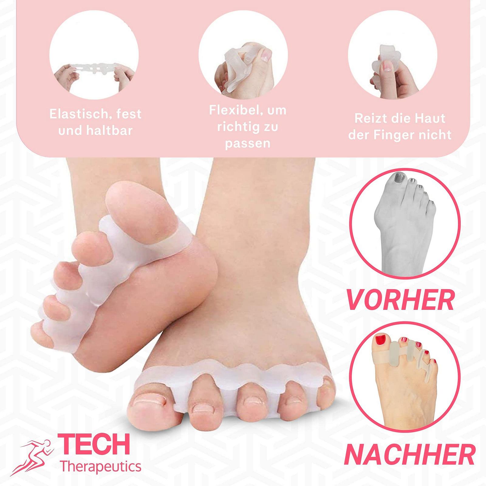 Коректор великого пальця стопи TECH THERAPEUTICS Денний і нічний повний набір для жінок з роздільником для пальців і регульованими ремінцями Hallux Valgus Коректор Денний і нічний, фото №4 Коректор великого пальця стопи TECH THERAPEUTICS Денний і нічний повний набір для жінок з роздільником для пальців і регульованими ремінцями Hallux Valgus Коректор Денний і нічний, фото №4