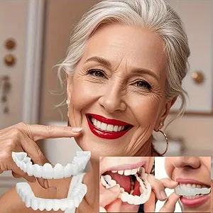 Вініри для зубів SnapOn Smile Veneers - Фото 1