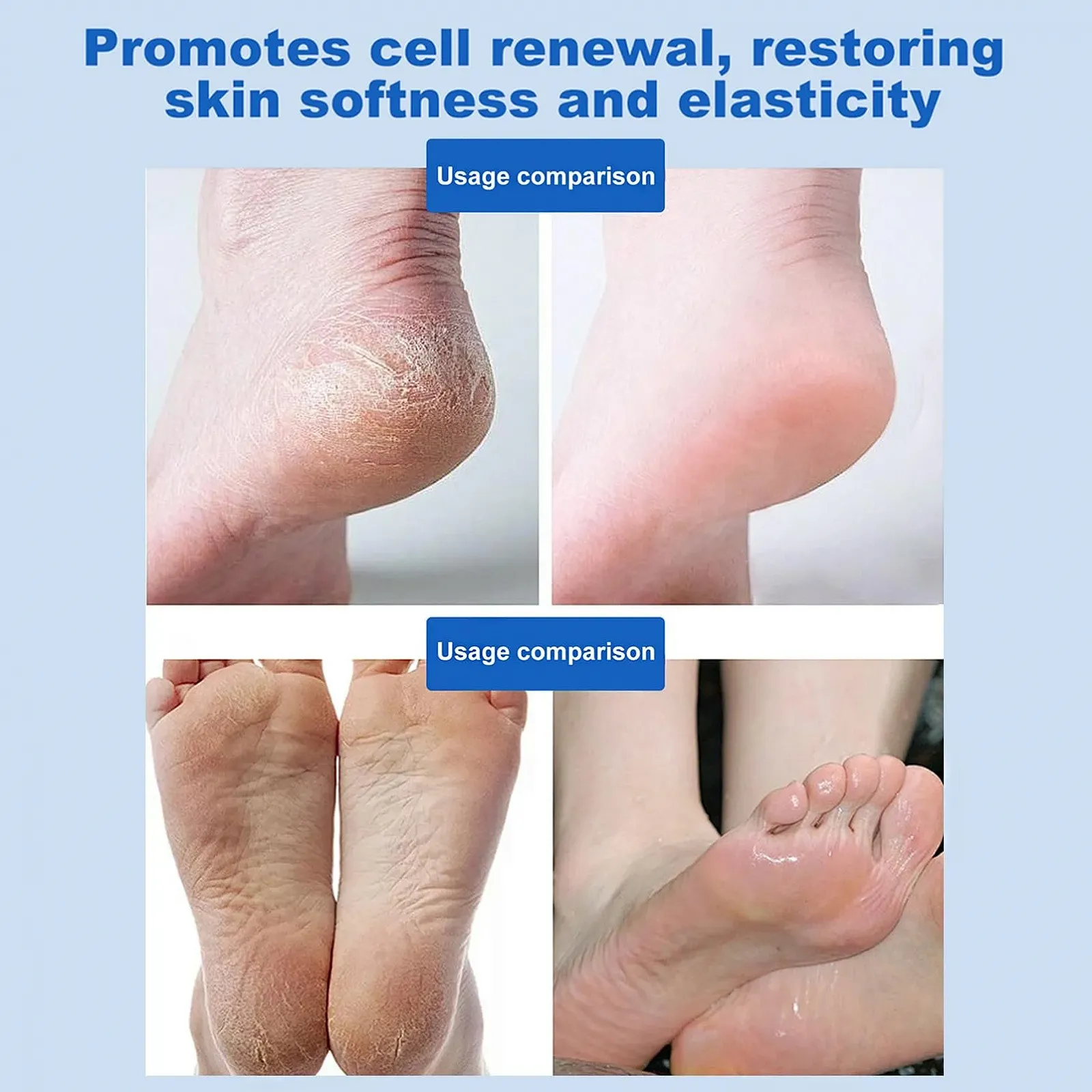 Крем для ног и рук Callus Remover Balm с мочевиной 60% и авокадо, 40 г, фото №5 Крем для ног и рук Callus Remover Balm с мочевиной 60% и авокадо, 40 г, фото №5