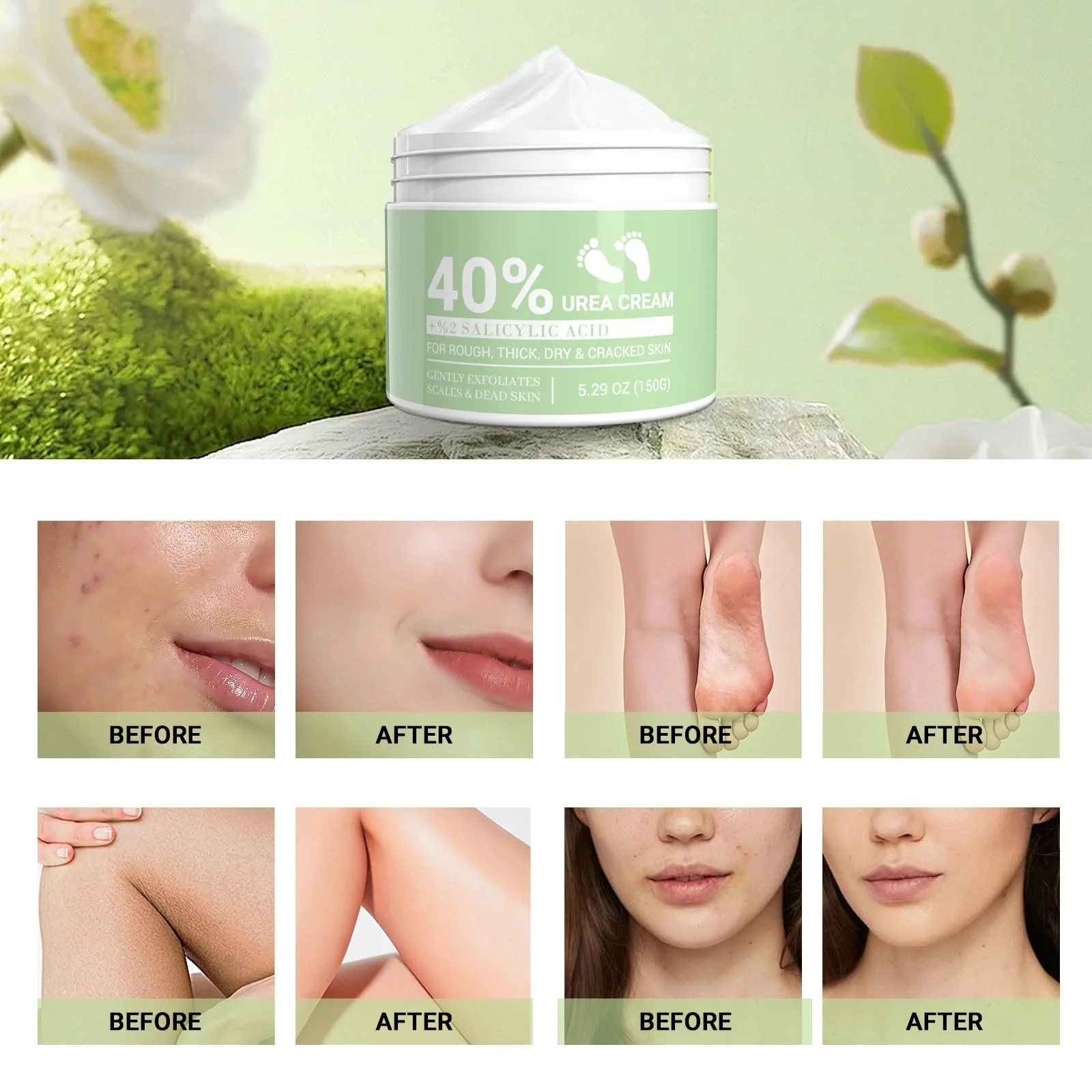 Крем для ног Urea Cream 40% от мозолей, фото №3