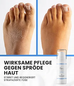 Крем для ног Pedi-Care Foot Care с мочевиной 150 мл против мозолей для сухой кожи synthetic.ua - Фото 1