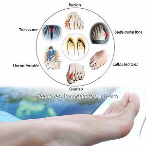 Коректор Вальгусної Деформації Великого Пальця Стопи synthetic.ua - Фото 1