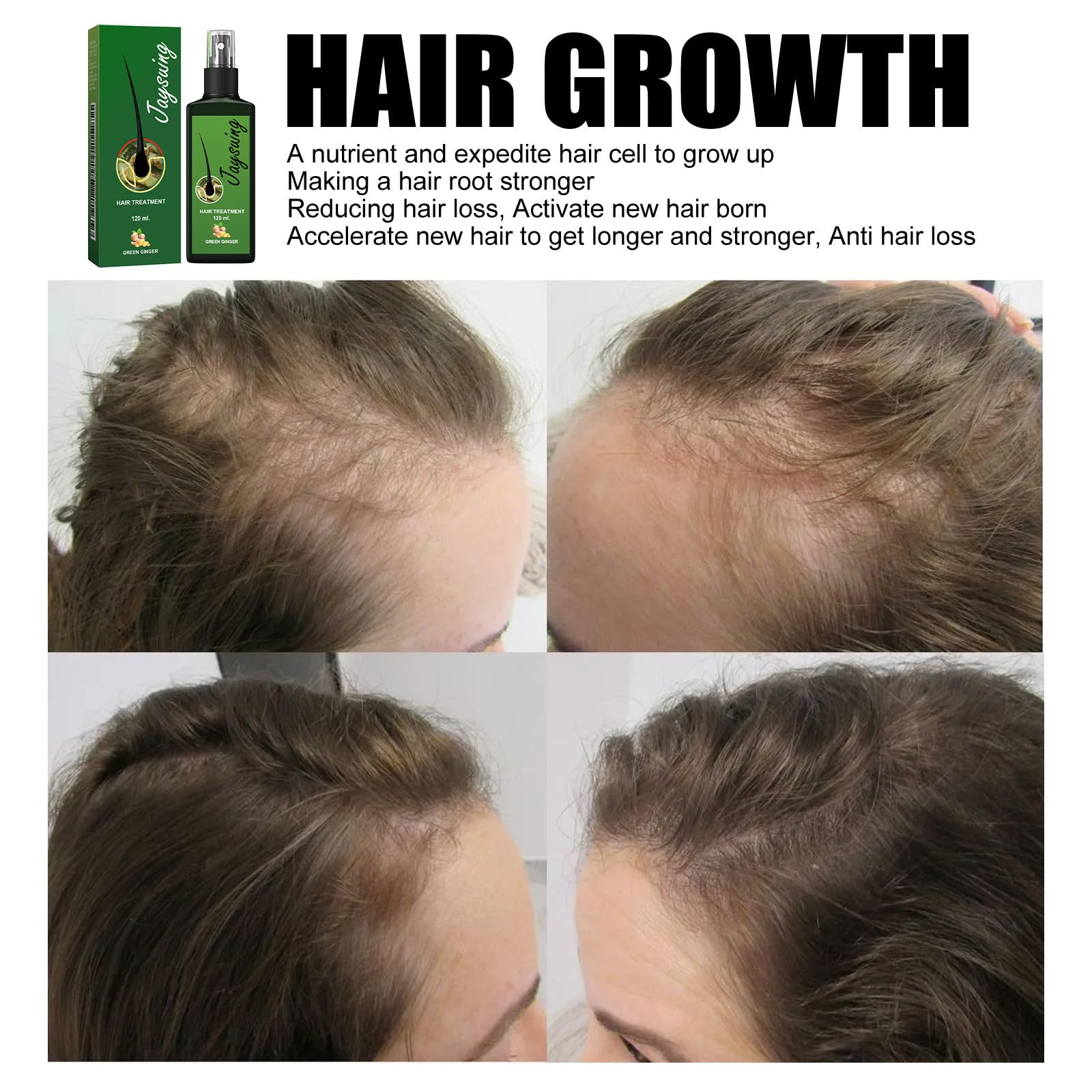 Кондиціонер для волосся, Зволожує сухе волосся, Відновлює пошкоджене волосся, Усвідомлює посічені кінчики та збільшує блиск, Запобігає випадінню волосся у чоловіків та жінок і ламкості волосся, 120 мл, фото №4