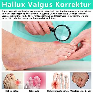 Корректор большого пальца стопы Hallux Valgus synthetic.ua - Фото 1