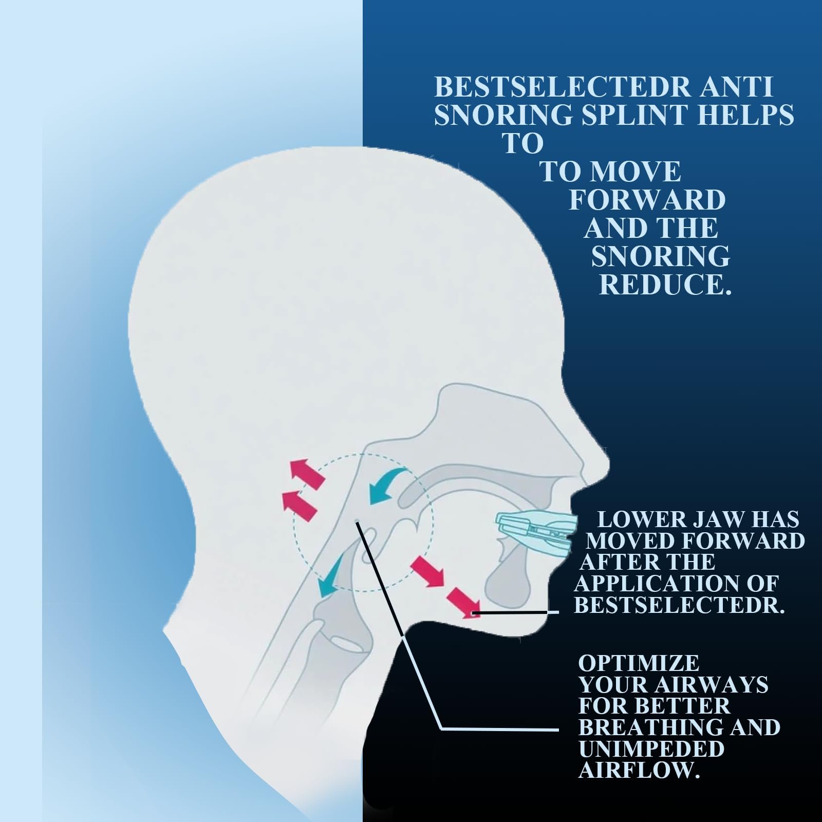 Капа від хропіння, Стопер, фото №3