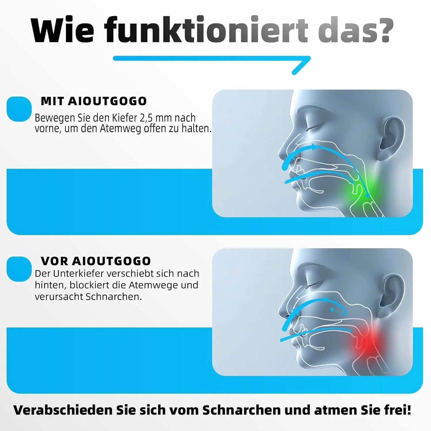 Щипці проти хропіння AIOUTGOGO, Легкі, проти хропіння, 180 градусів, білі (1 шт), фото №2 Щипці проти хропіння AIOUTGOGO, Легкі, проти хропіння, 180 градусів, білі (1 шт), фото №2
