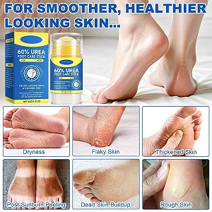 Крем-стик для ног Urea Cream 60% увлажняющий от трещин с 2% кислотой 2 шт synthetic.ua - Фото 1