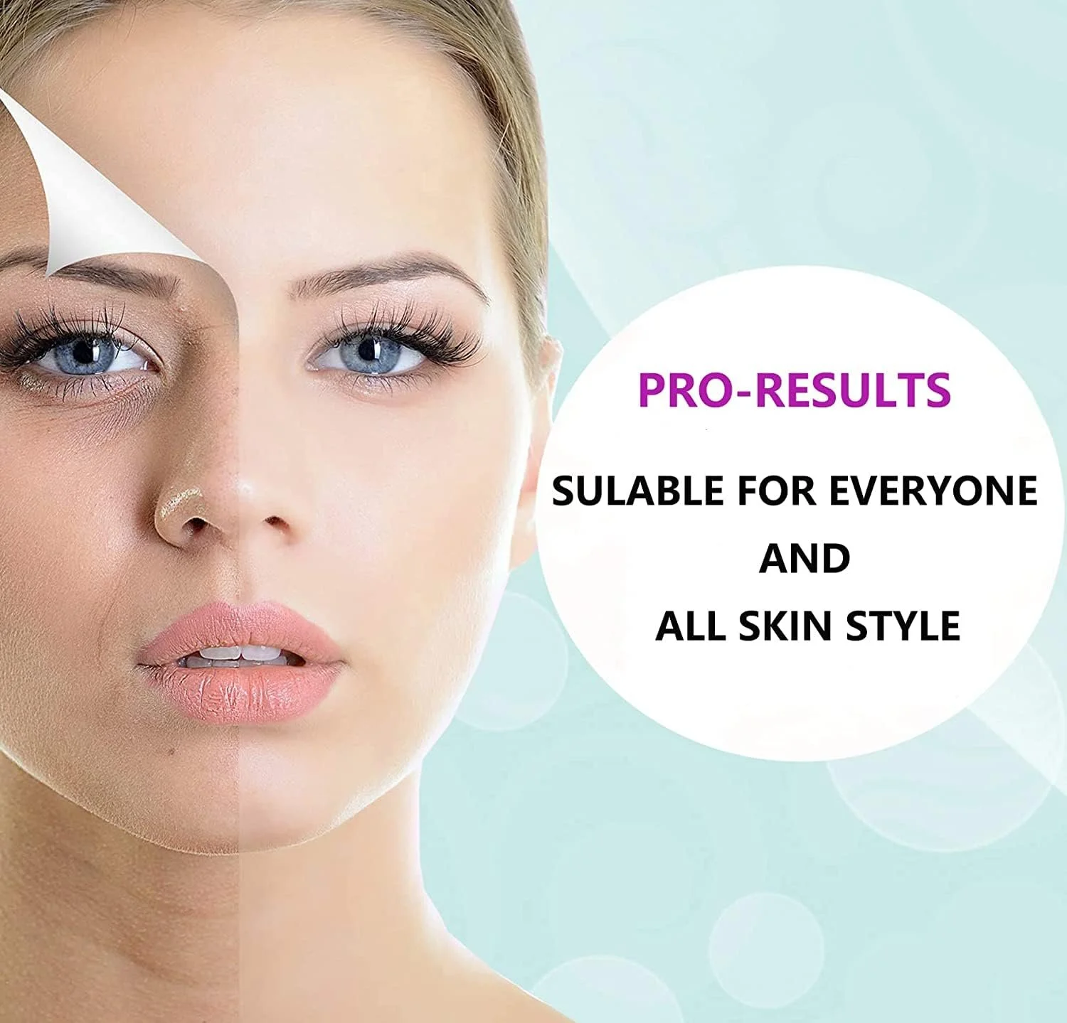 Дермаролер Angel Kiss 4 в 1, набір мікроголкових ролерів, 300 голок 0,5 мм, 720/1200 голок, 1,0 мм, фото №5