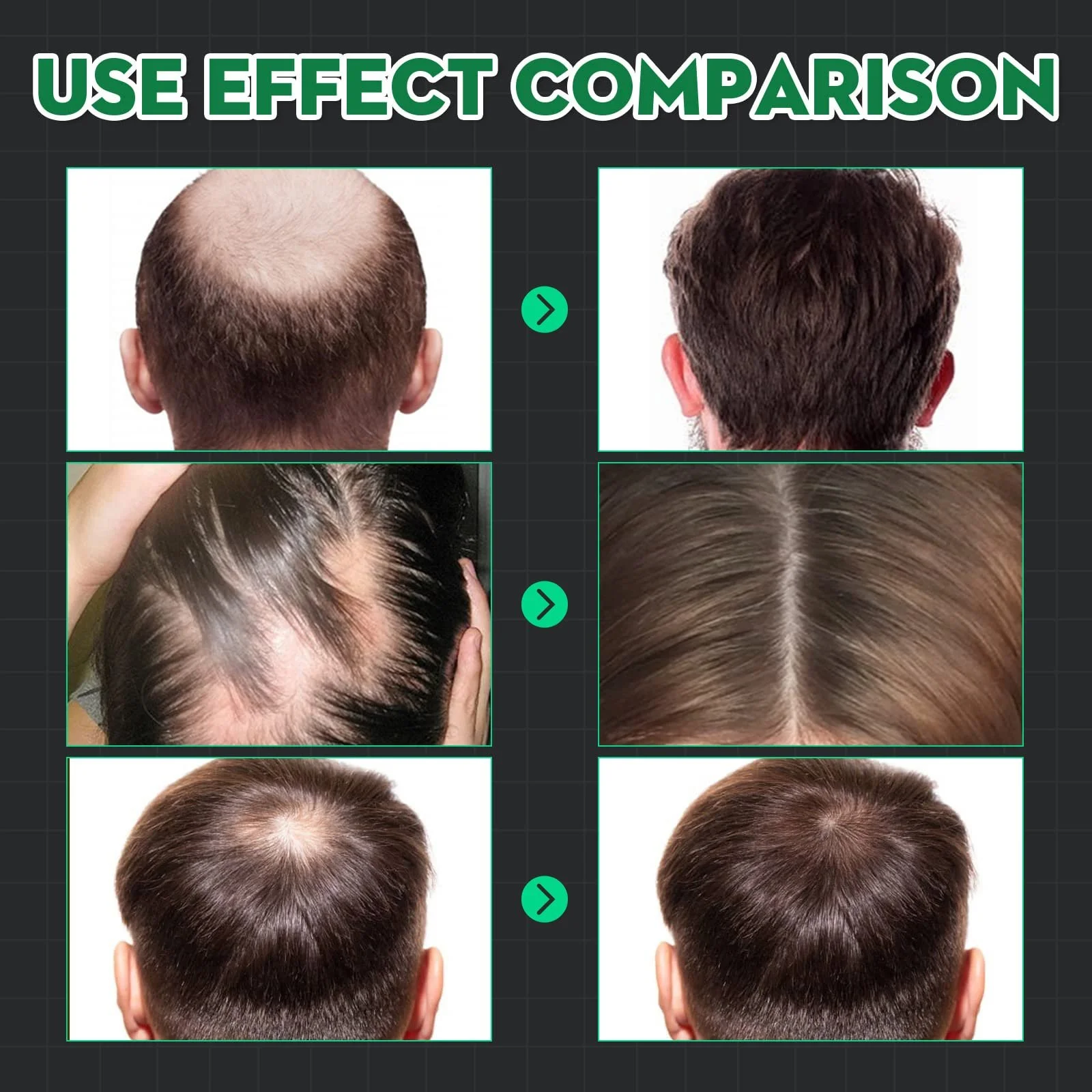 Сироватка для росту волосся Tkekruh 120 мл (2 шт.), фото №3