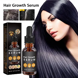 Сыворотка для волос для быстрого роста волос Стимулирующая рост сыворотка для волос Средства для роста волос для мужчин и женщин 30 мл synthetic.ua - Фото 1