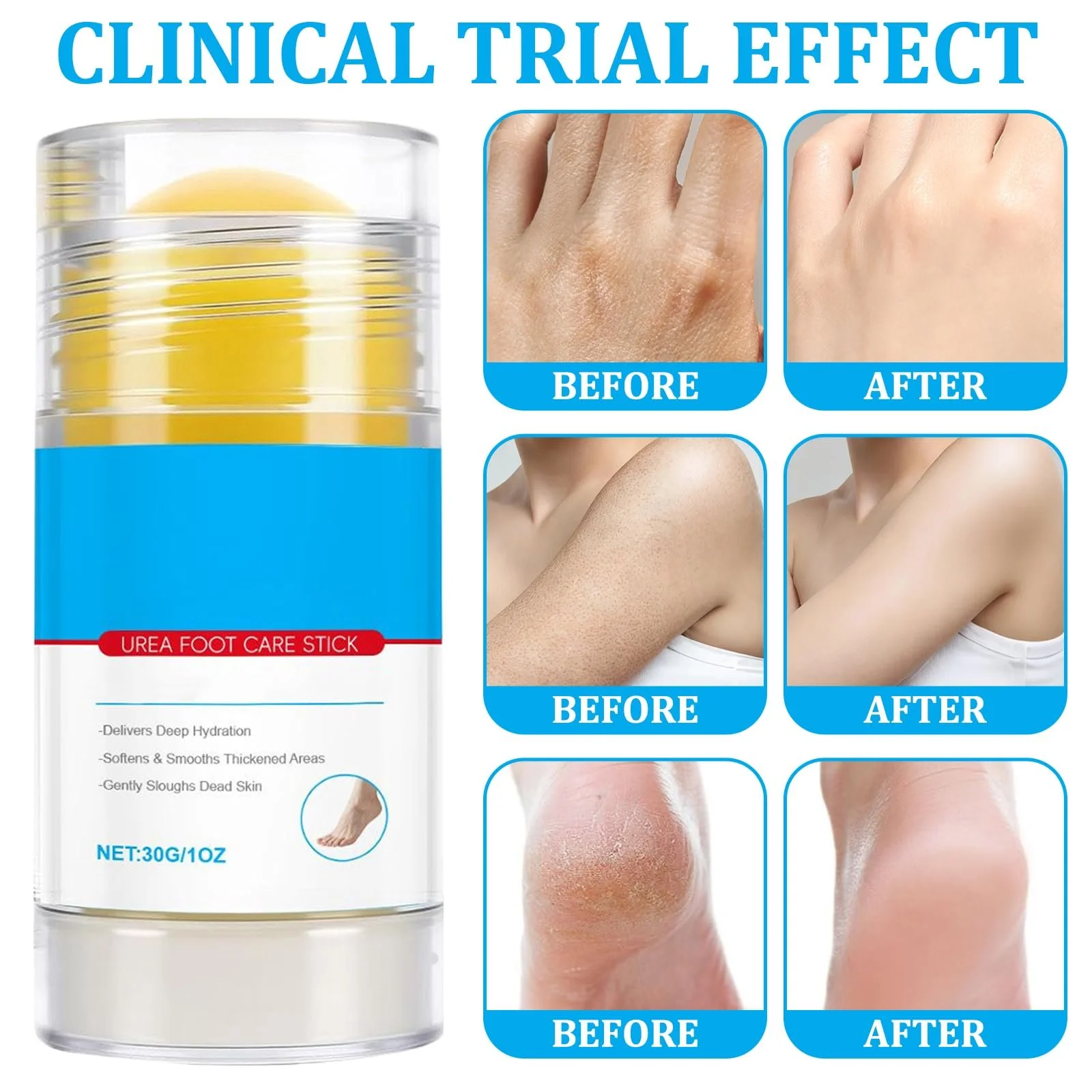 Крем для ног Urea 60% для очень сухой и огрубевшей кожи 60%, фото №2 Крем для ног Urea 60% для очень сухой и огрубевшей кожи 60%, фото №2