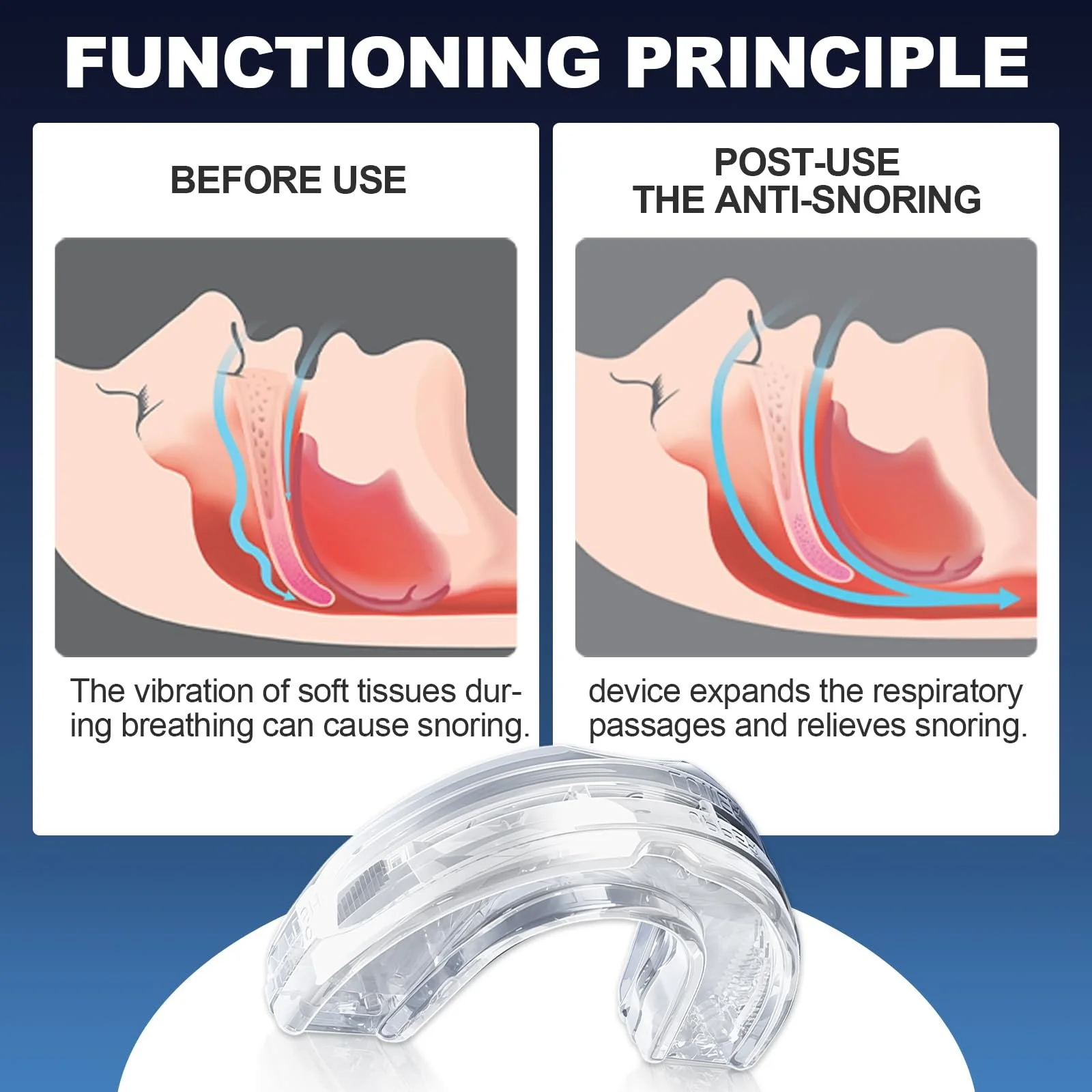 Капа от храпа Эффективная капа от храпа Удобная, фото №4 Капа от храпа Эффективная капа от храпа Удобная, фото №4