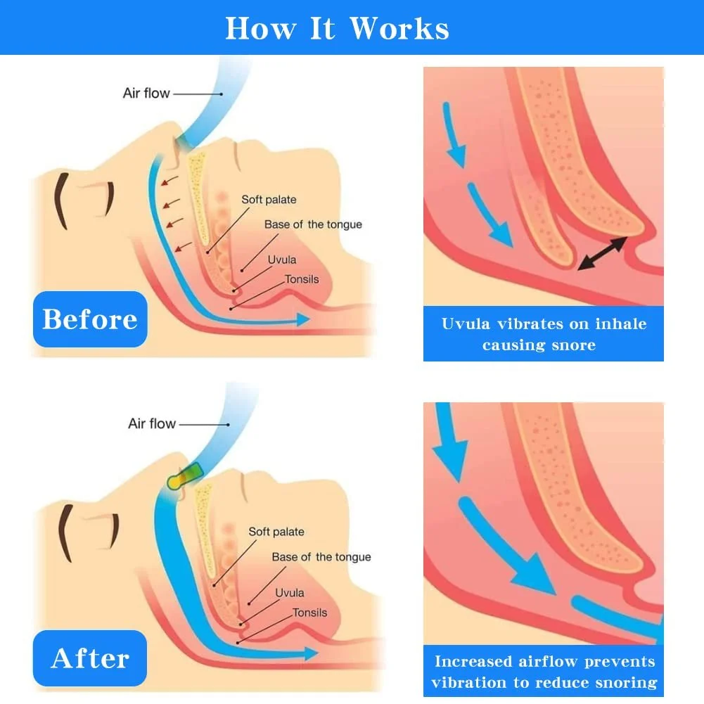 Засіб від хропіння Силіконовий кліпс для носа 8 шт, фото №2