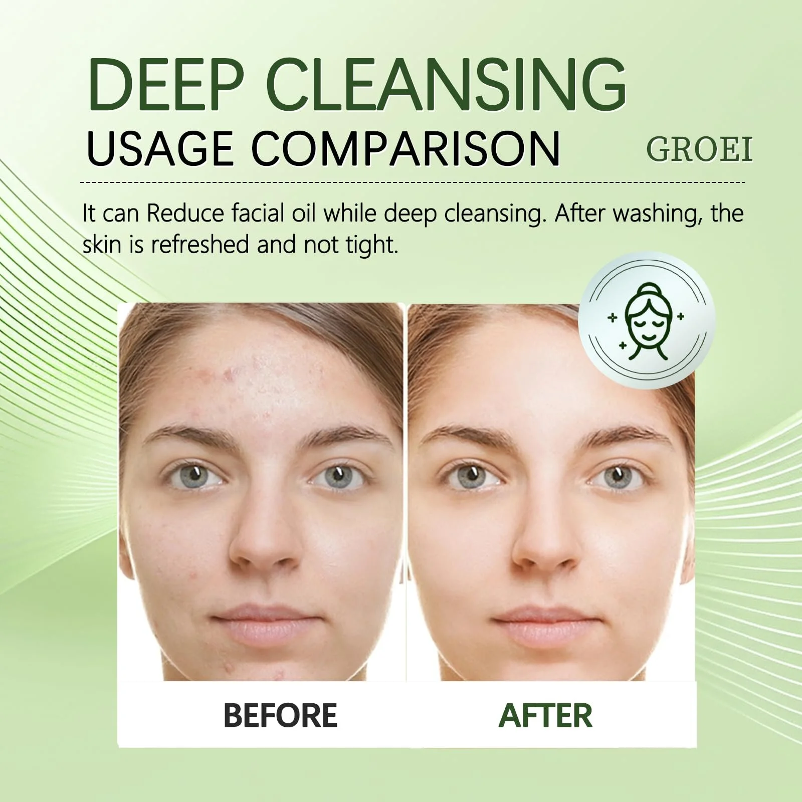 Гель для вмивання з чайним деревом і гліцерином для глибокого очищення пор для чутливої шкіри, 150 мл, фото №7 Гель для вмивання з чайним деревом і гліцерином для глибокого очищення пор для чутливої шкіри, 150 мл, фото №7