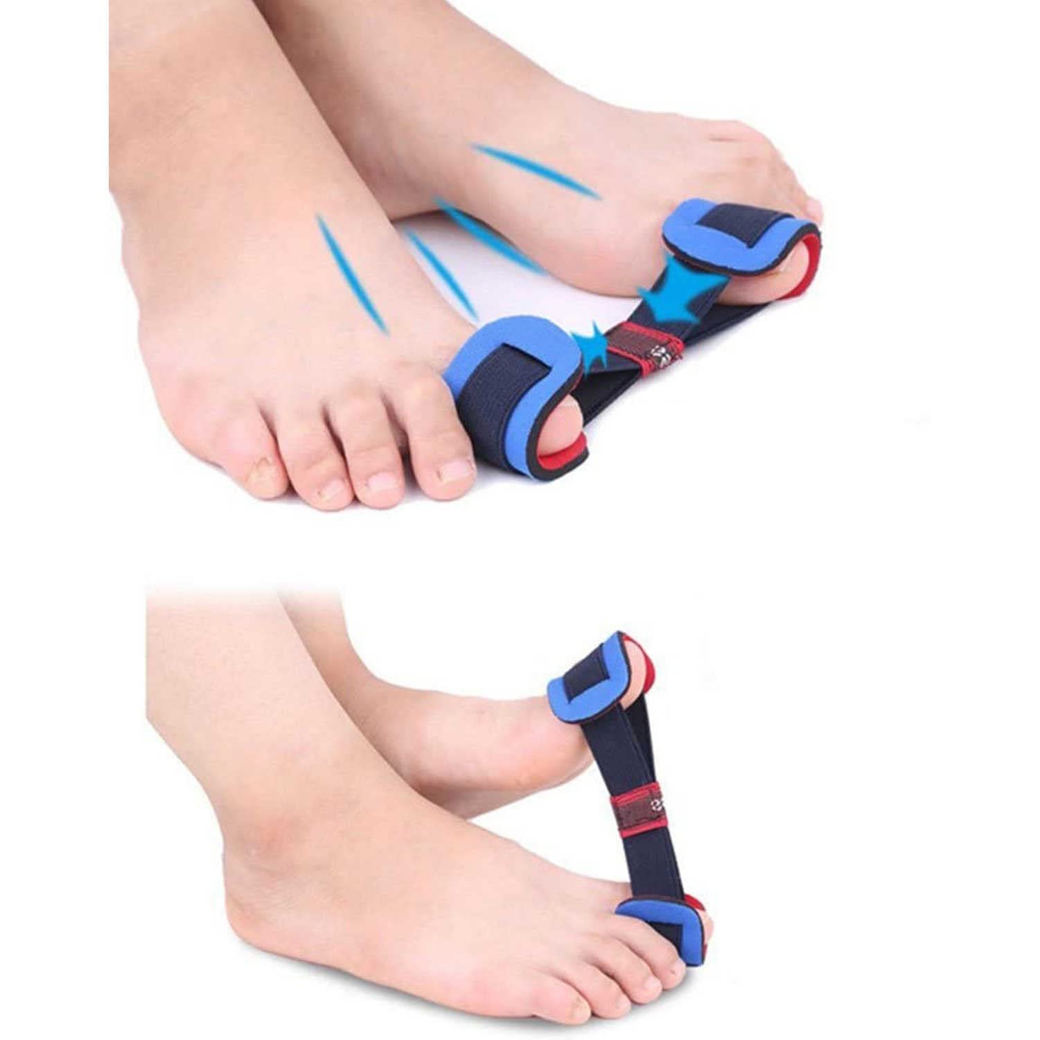 Роздільник для пальців ніг Hallux Valgus TMXKOOK, Коригувальна пов'язка-шкарпетки, фото №4