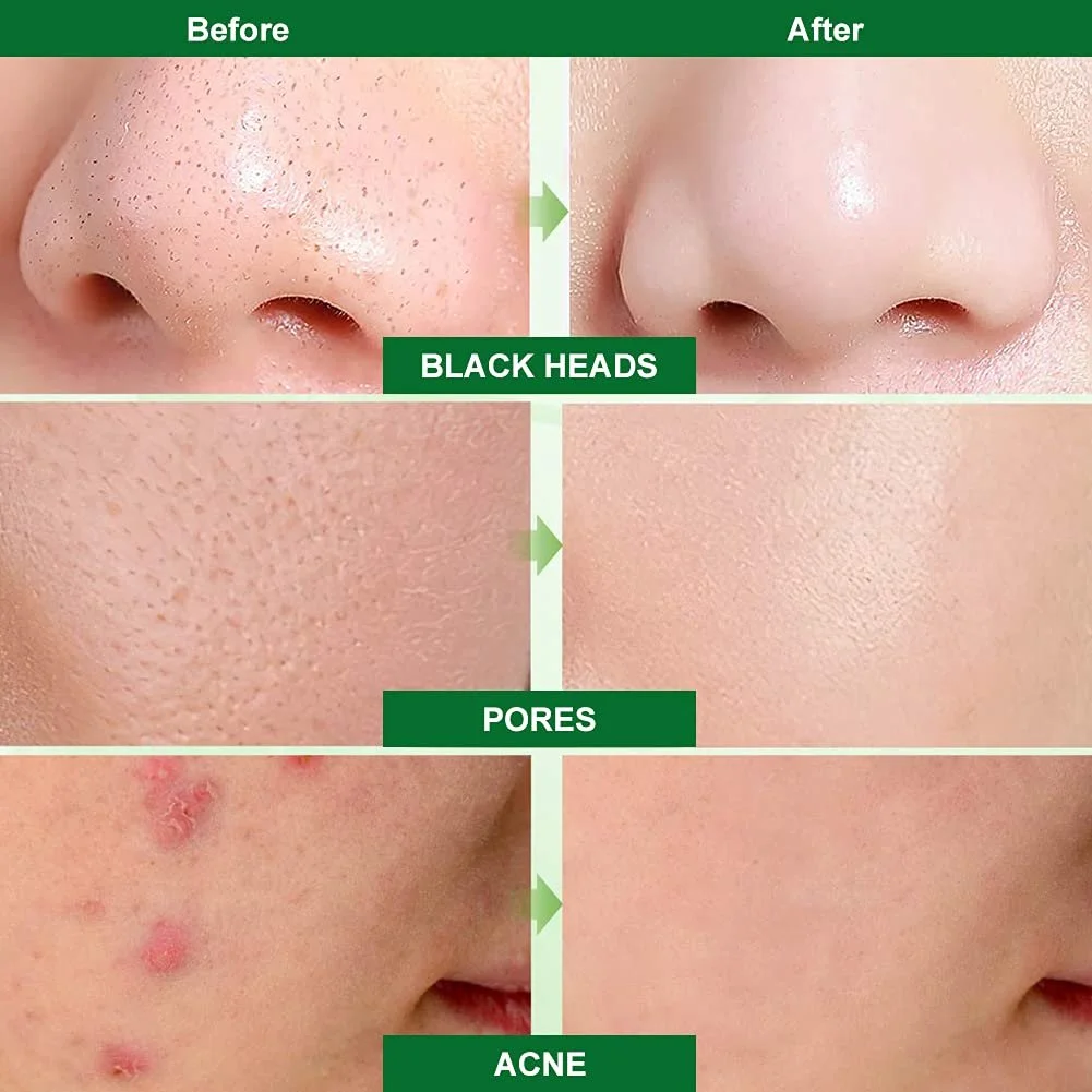 Маска для обличчя Вугільна маска від чорних цяток Bamboo для очищення пор Контроль жирності Очищення 200 г, фото №6