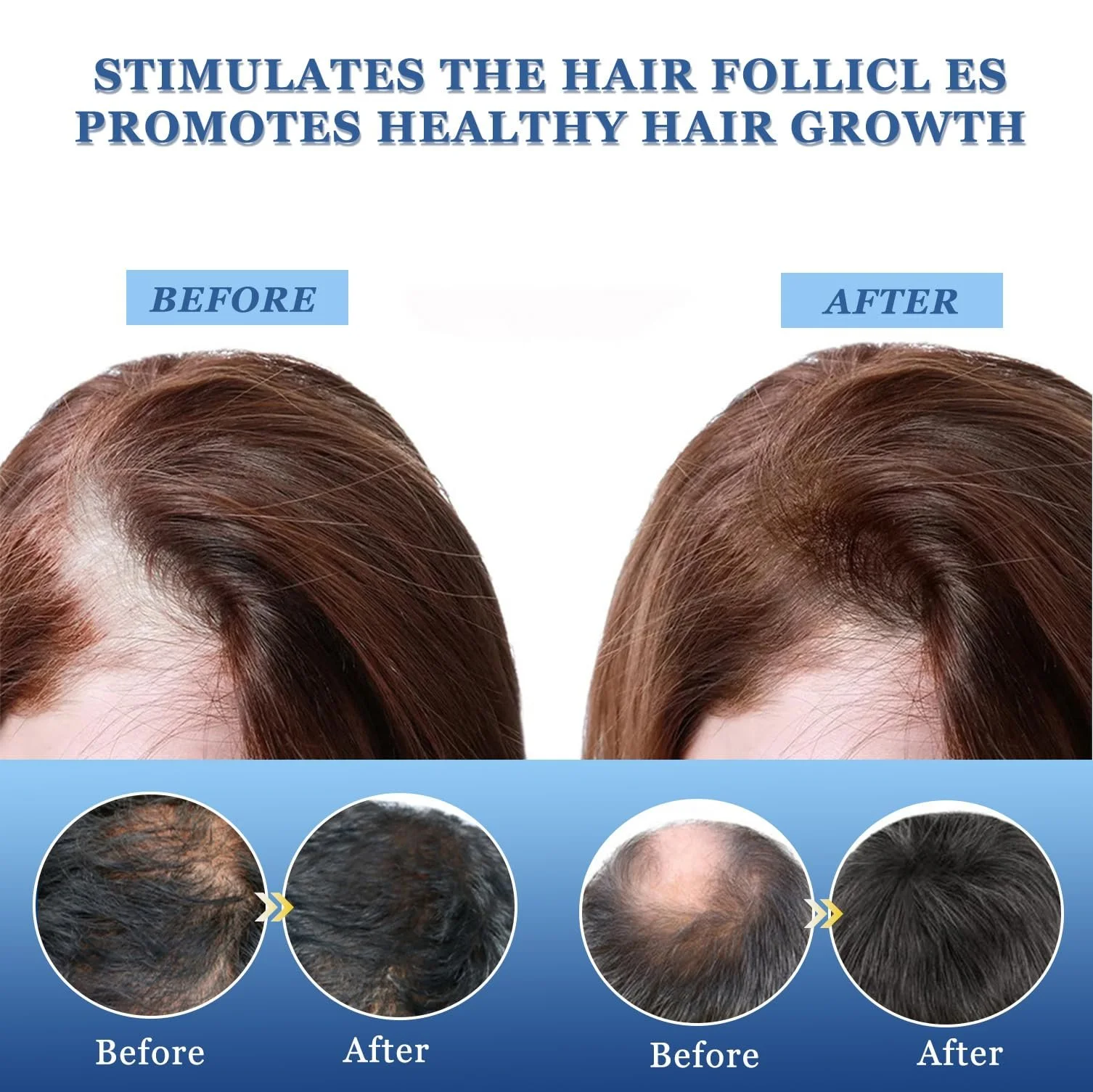 Крем против выпадения волос Cream, 20 г, ускоряет рост волос, эссенция для ухода за волосяными фолликулами, эффективный рост волос, фото №3