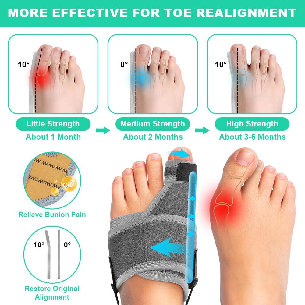 Шина для корекції Hallux Valgus Vicloon, фото №2 Шина для корекції Hallux Valgus Vicloon, фото №2