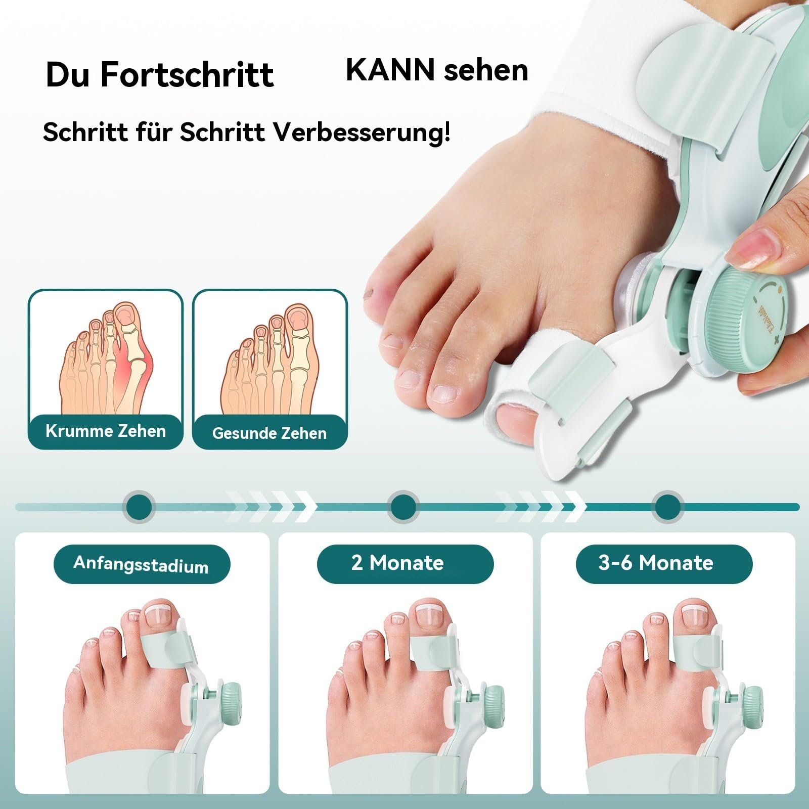 Шина для корекції Hallux Valgus EliaValth Регульований коректор кісточки з поворотним регулятором, фото №3 Шина для корекції Hallux Valgus EliaValth Регульований коректор кісточки з поворотним регулятором, фото №3