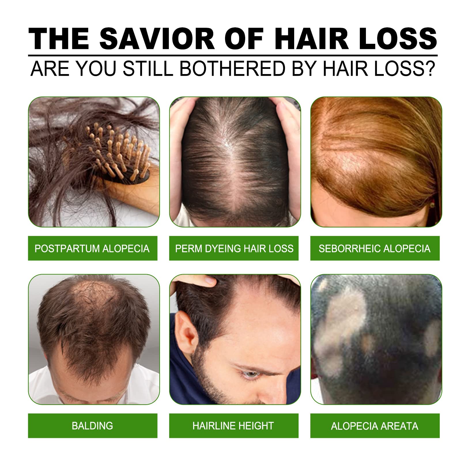 Кондиціонер для волосся, Зволожує сухе волосся, Відновлює пошкоджене волосся, Усвідомлює посічені кінчики та збільшує блиск, Запобігає випадінню волосся у чоловіків та жінок і ламкості волосся, 120 мл, фото №3