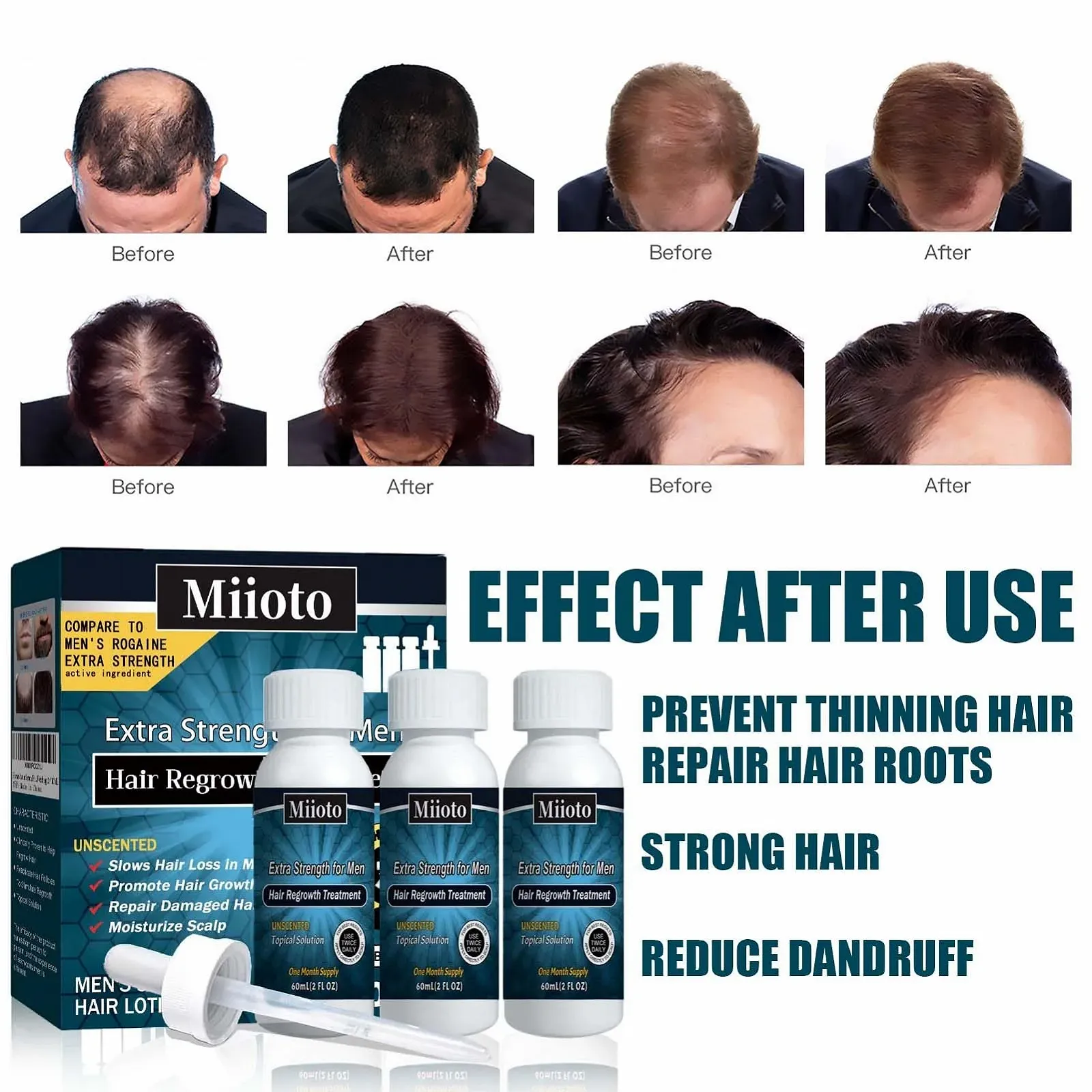 Сыворотка Miioto для роста волос, 180 мл, фото №5