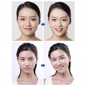 Стрічка для підтяжки обличчя A/R Водонепроникна стрічка для підтяжки обличчя synthetic.ua - Фото 1