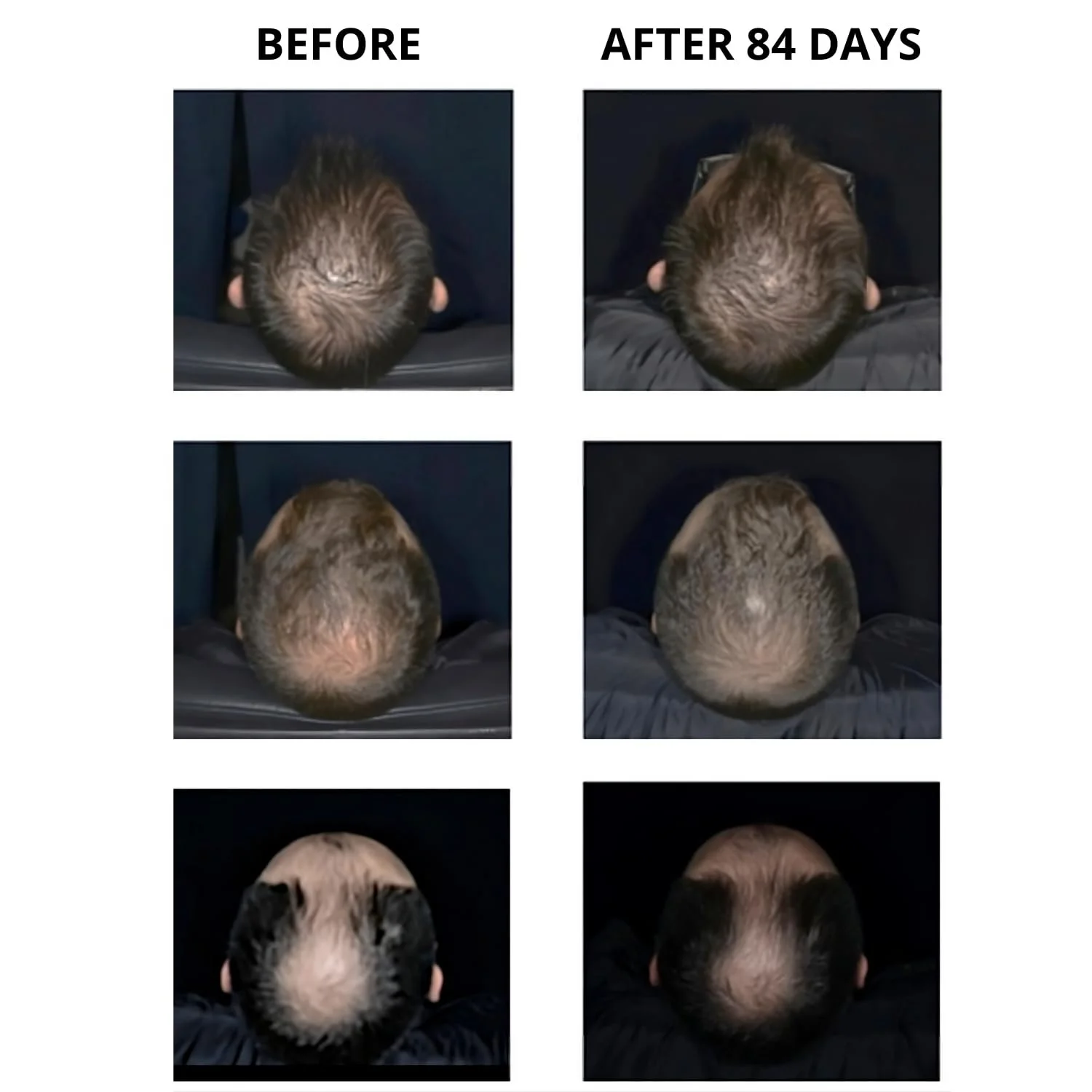 Сироватка для росту волосся Sattva Ayurveda з екстрактом розмарину та Redensyl для лікування випадіння волосся у жінок та чоловіків, фото №5 Сироватка для росту волосся Sattva Ayurveda з екстрактом розмарину та Redensyl для лікування випадіння волосся у жінок та чоловіків, фото №5