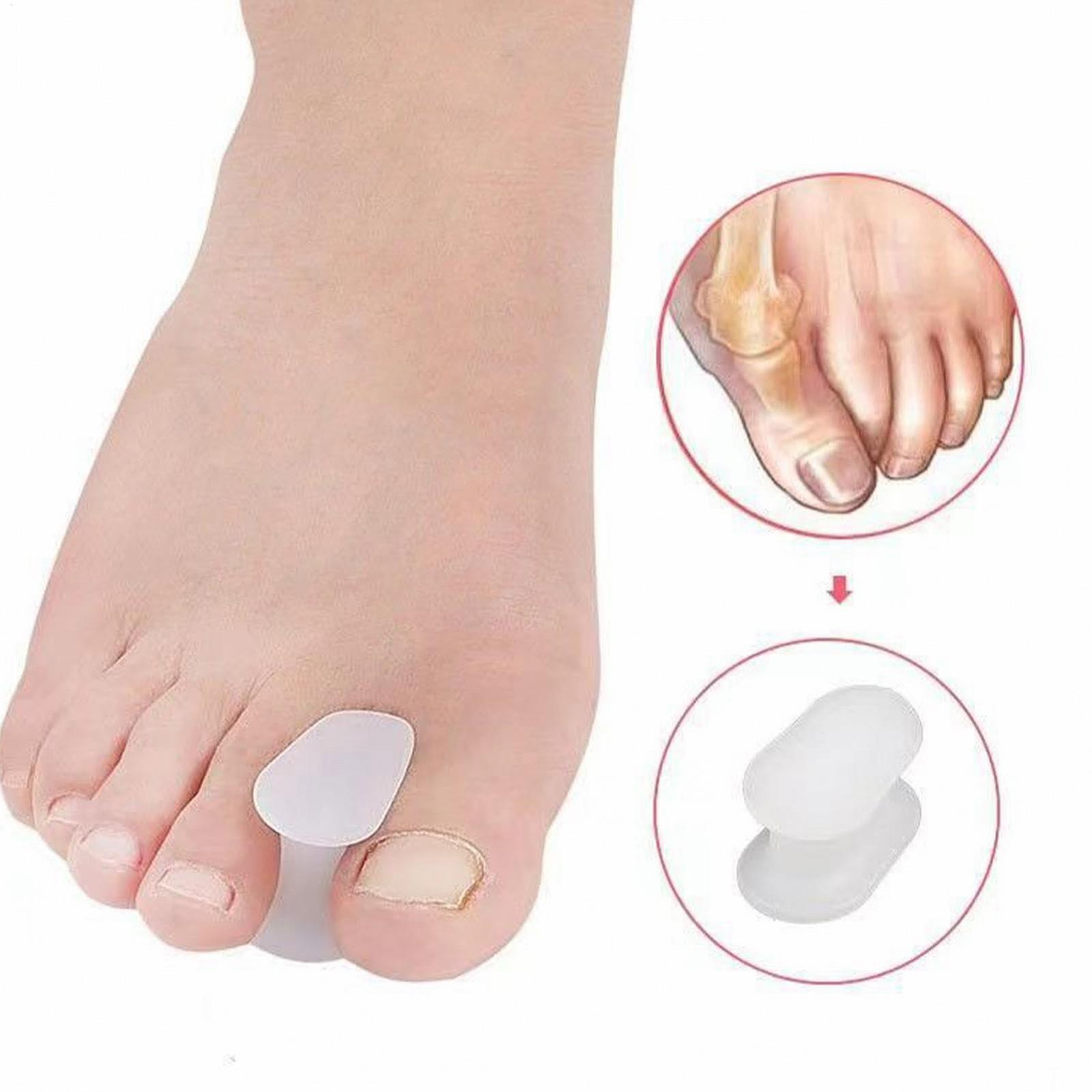 Роздільник для великих пальців ніг Гелевий Відновлення роздільника пальців, фото №6 Роздільник для великих пальців ніг Гелевий Відновлення роздільника пальців, фото №6