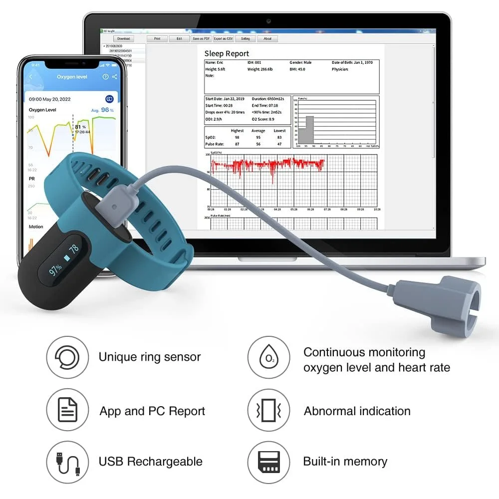 Пульсоксиметр ViATOM SleepU Черно-бирюзовый, фото №4 Пульсоксиметр ViATOM SleepU Черно-бирюзовый, фото №4