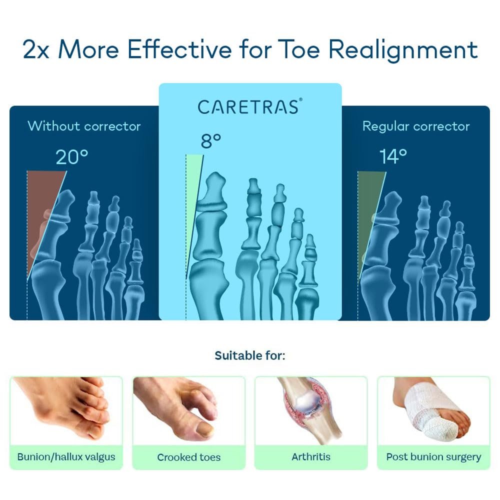 Шина для корекції Hallux Valgus 2 шт. Регульований коректор вальгусної деформації, фото №3