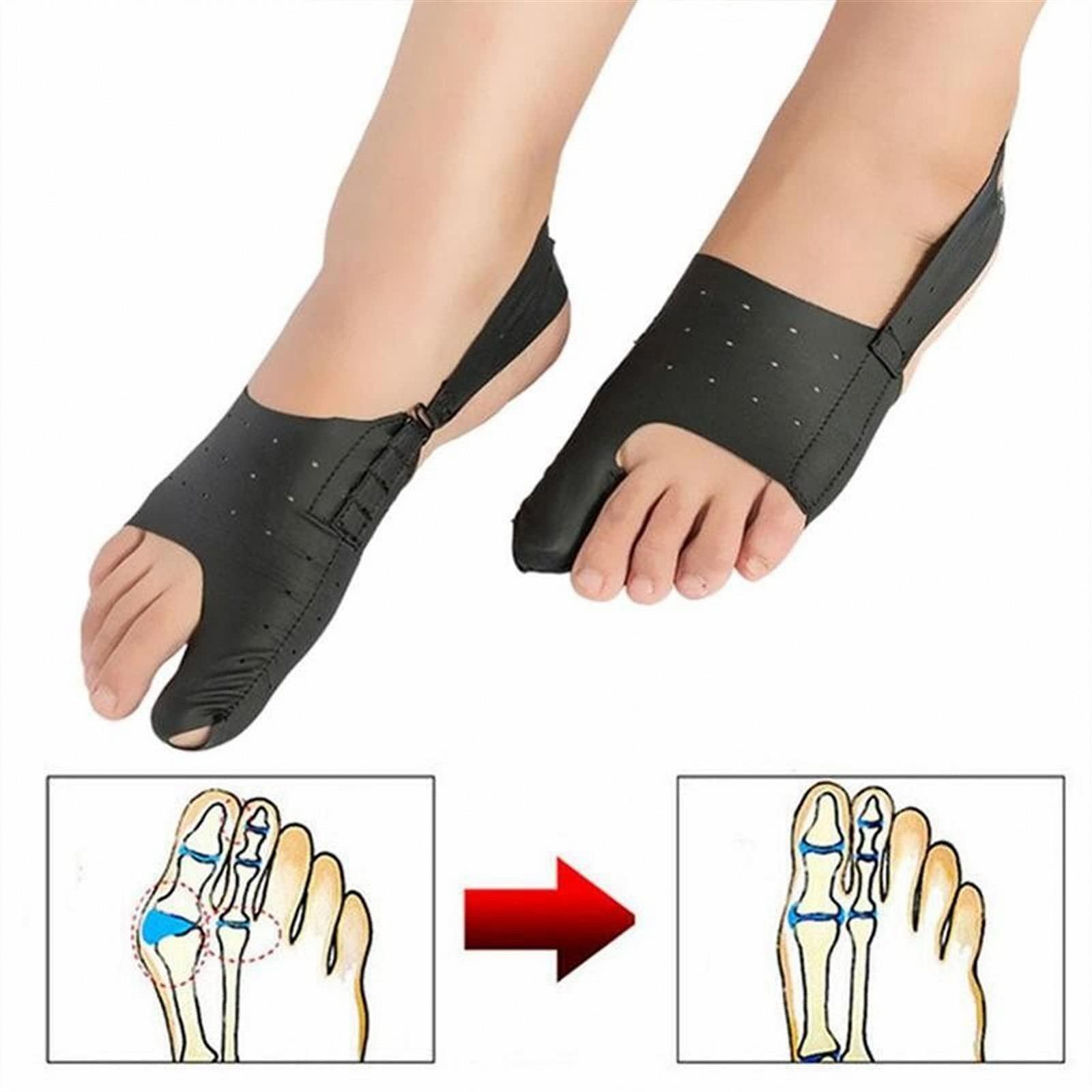 Роздільник для пальців Hallux Valgus Шина Коректор вальгусної деформації великого пальця, фото №6 Роздільник для пальців Hallux Valgus Шина Коректор вальгусної деформації великого пальця, фото №6