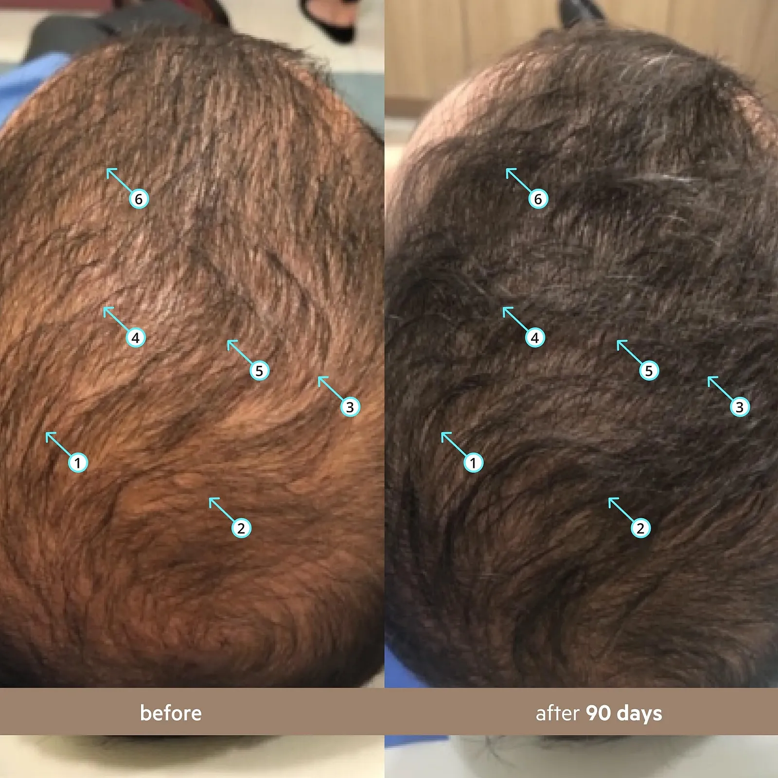 Сироватка DS Labs Spectral Men's для збільшення густоти волосся у чоловіків, зміцнення, потовщення, зменшення випадіння волосся, фото №3