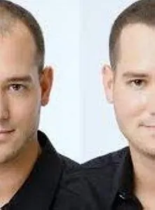 Волокна для волос Beaver KERATIN для маскировки залысин 28г Темно-коричневый synthetic.ua - Фото 1