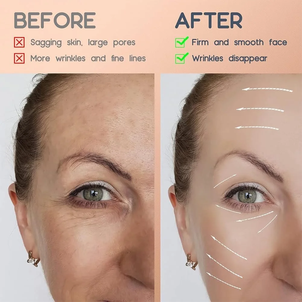 Тейп для обличчя Anti Wrinkle Plasters, Набір 2 шт, для ліфтингу обличчя, для розгладження, фото №2