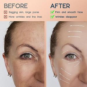 Тейп для лица Anti Wrinkle Plasters, Набор 2 шт, для разглаживания, для лифтинга лица. synthetic.ua - Фото 1