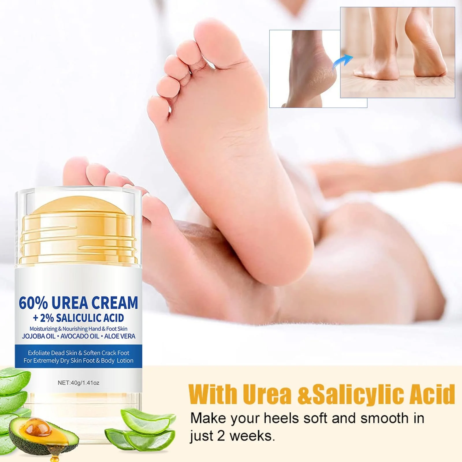 Крем для ног Urea 60% увлажняющий с алоэ вера 2 шт., фото №6 Крем для ног Urea 60% увлажняющий с алоэ вера 2 шт., фото №6
