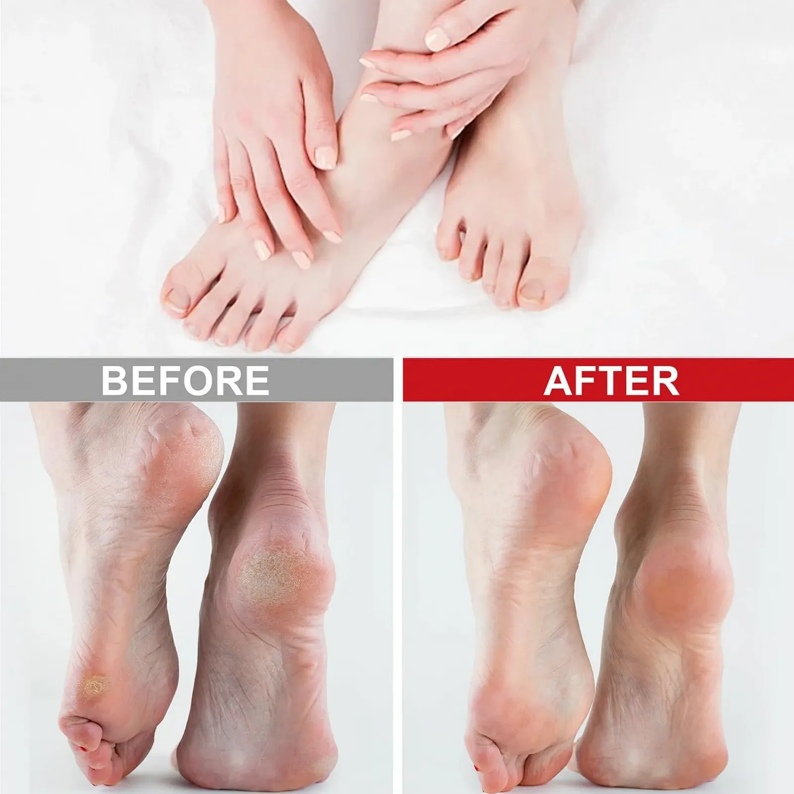 Крем для ног и рук Urea Cream 60% Repair 200 g, фото №6