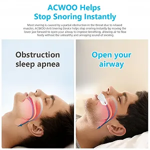 Средство от храпа ACWOO, шина, безопасное и прочное synthetic.ua - Фото 1