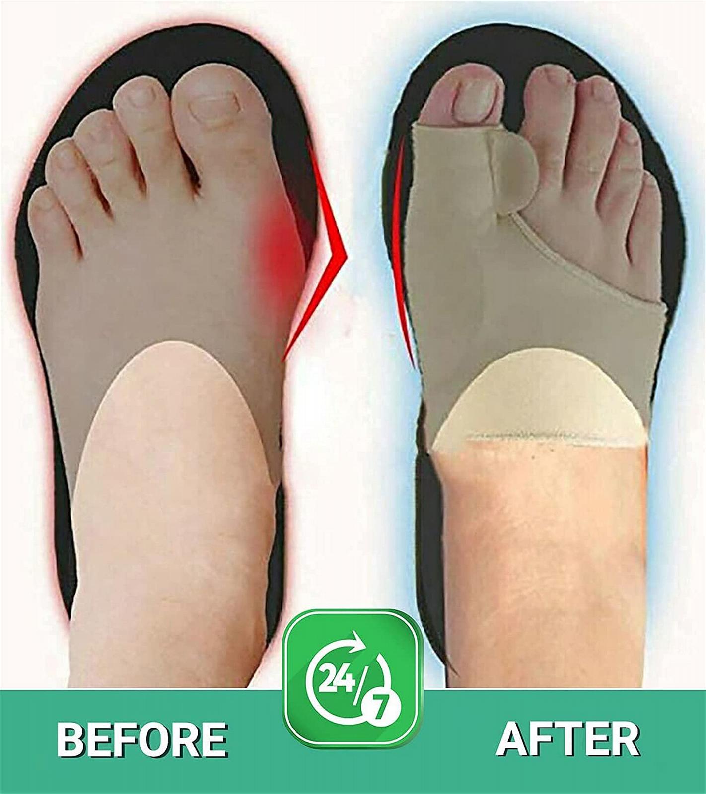 Роздільник для пальців ніг 2 пари, Роздільники для пальців ніг, Захист від бурситу, фото №6