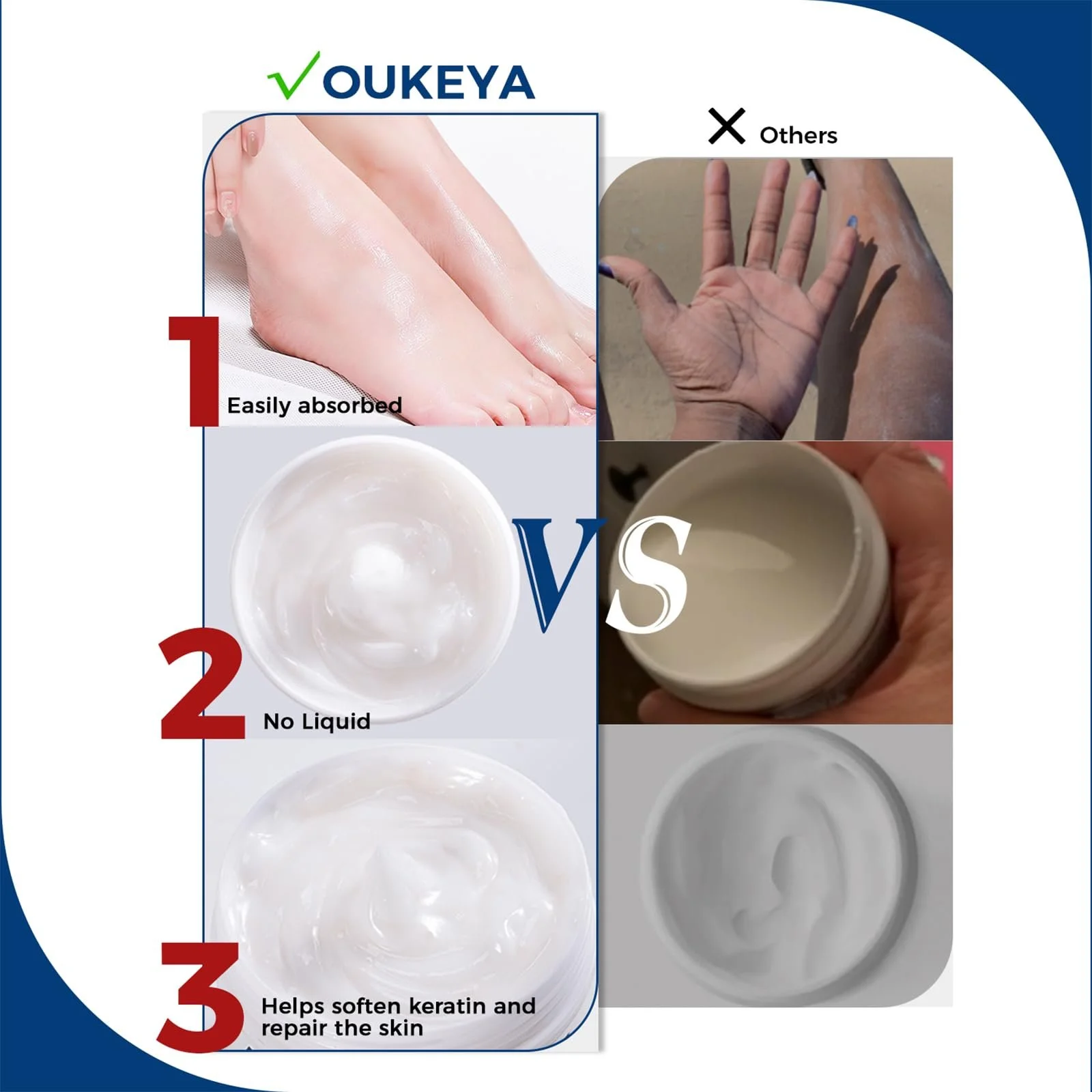 Крем для ног и рук OUKEYA Formula Urea Cream 40% Plus Salicylic Acid 2% увлажняющий и восстанавливающий, фото №7