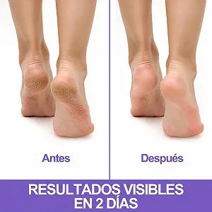 Питательный крем для ног Podovis Cracked Heel для потрескавшихся пяток 75 мл synthetic.ua - Фото 1