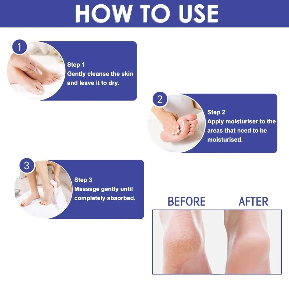 Крем для ног увлажняющий и питательный Pack of 2 для восстановления потрескавшихся пяток, смягчения сухой и грубой кожи рук и ног, фото №4