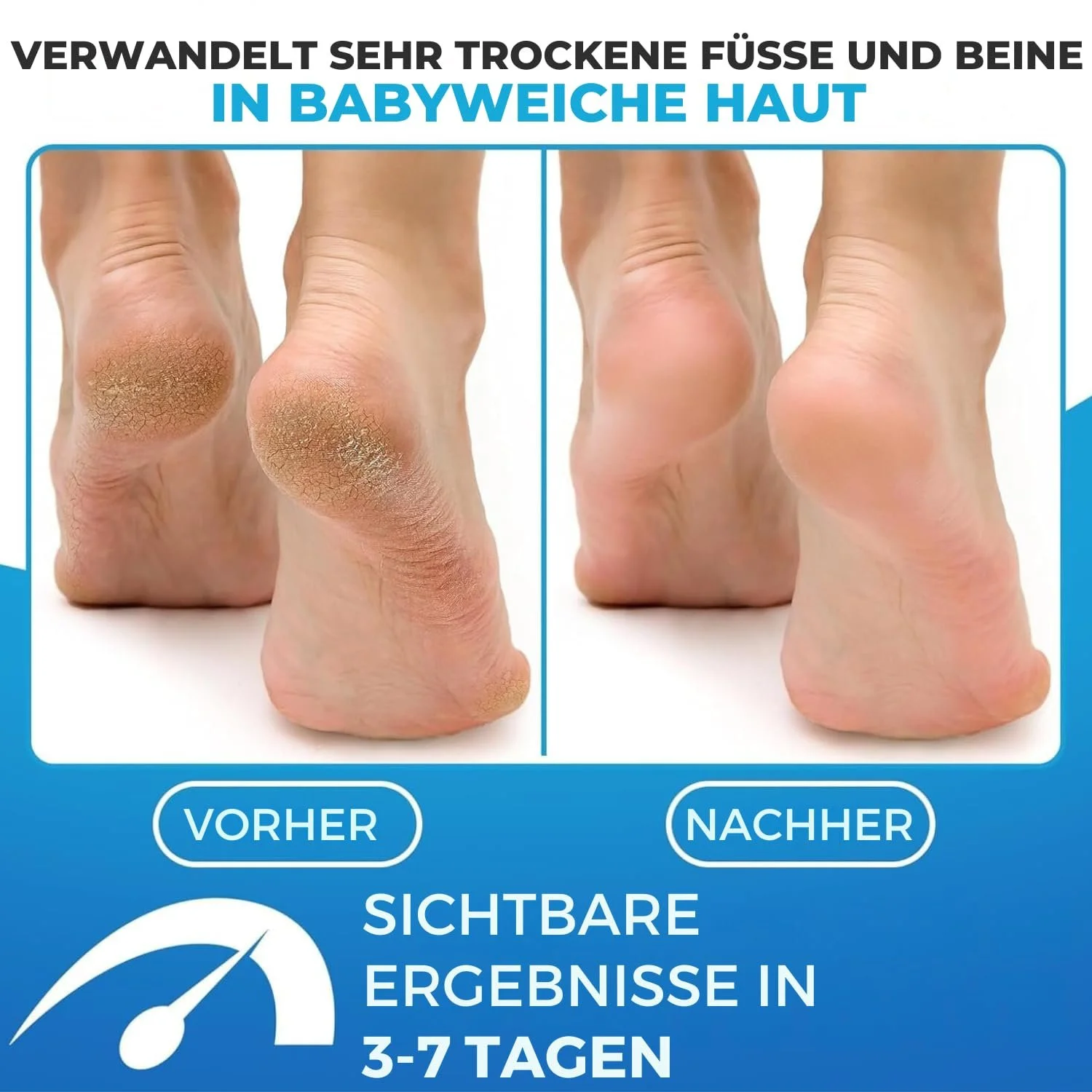 Бальзам для ніг Imperial Feet Foot Balm Soft з медом та алое зволожувальний без ароматизаторів 150 мл, фото №2