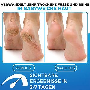 Бальзам для ніг Imperial Feet Foot Balm Soft з медом та алое зволожувальний без ароматизаторів 150 мл synthetic.ua - Фото 1