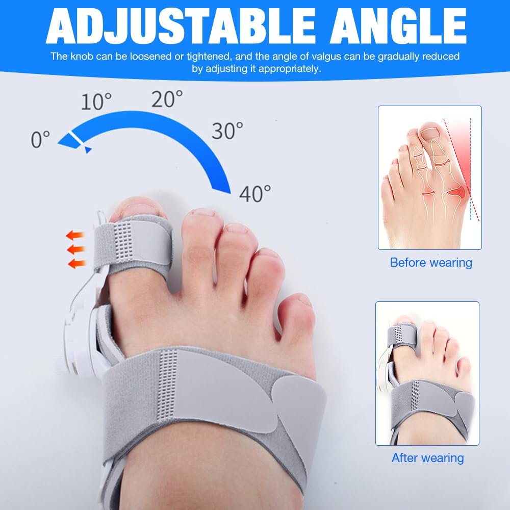 Шина для коррекции Hallux Valgus, регулируемая, обновленная, корректор большого пальца стопы, фото №2