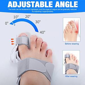 Шина для коррекции Hallux Valgus, регулируемая, обновленная, корректор большого пальца стопы synthetic.ua - Фото 1