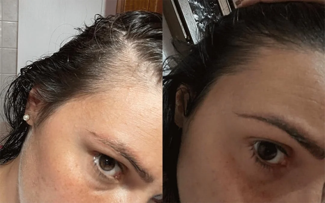 Лосьйон проти випадіння волосся Tricostrong Stanartis 100 мл, фото №8