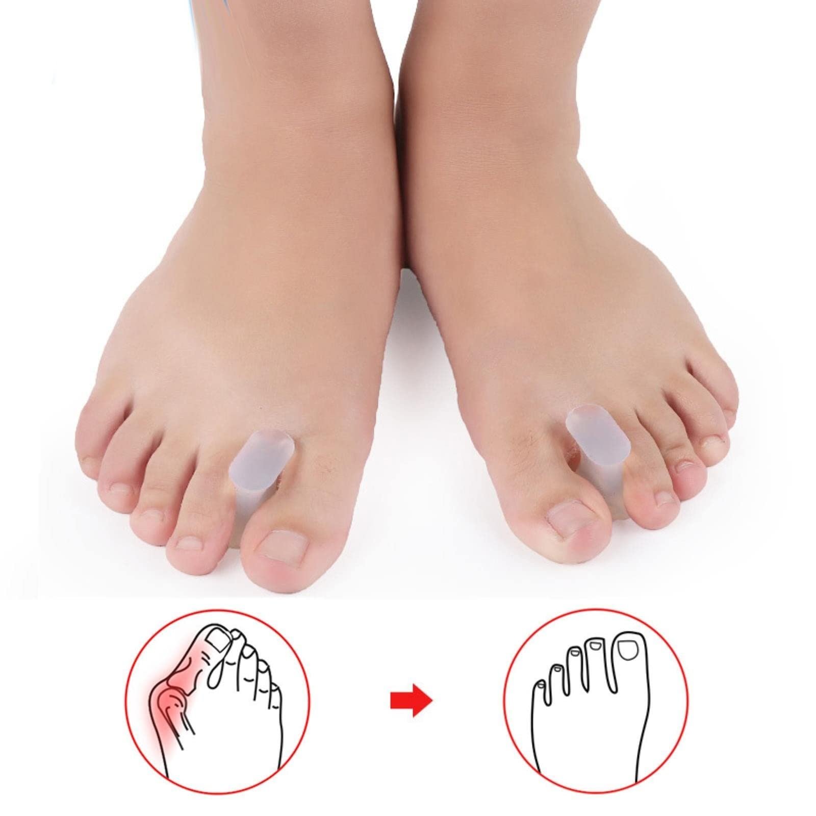Роздільник для пальців ніг гелевий 2 шт./пара ортопедичний, фото №7