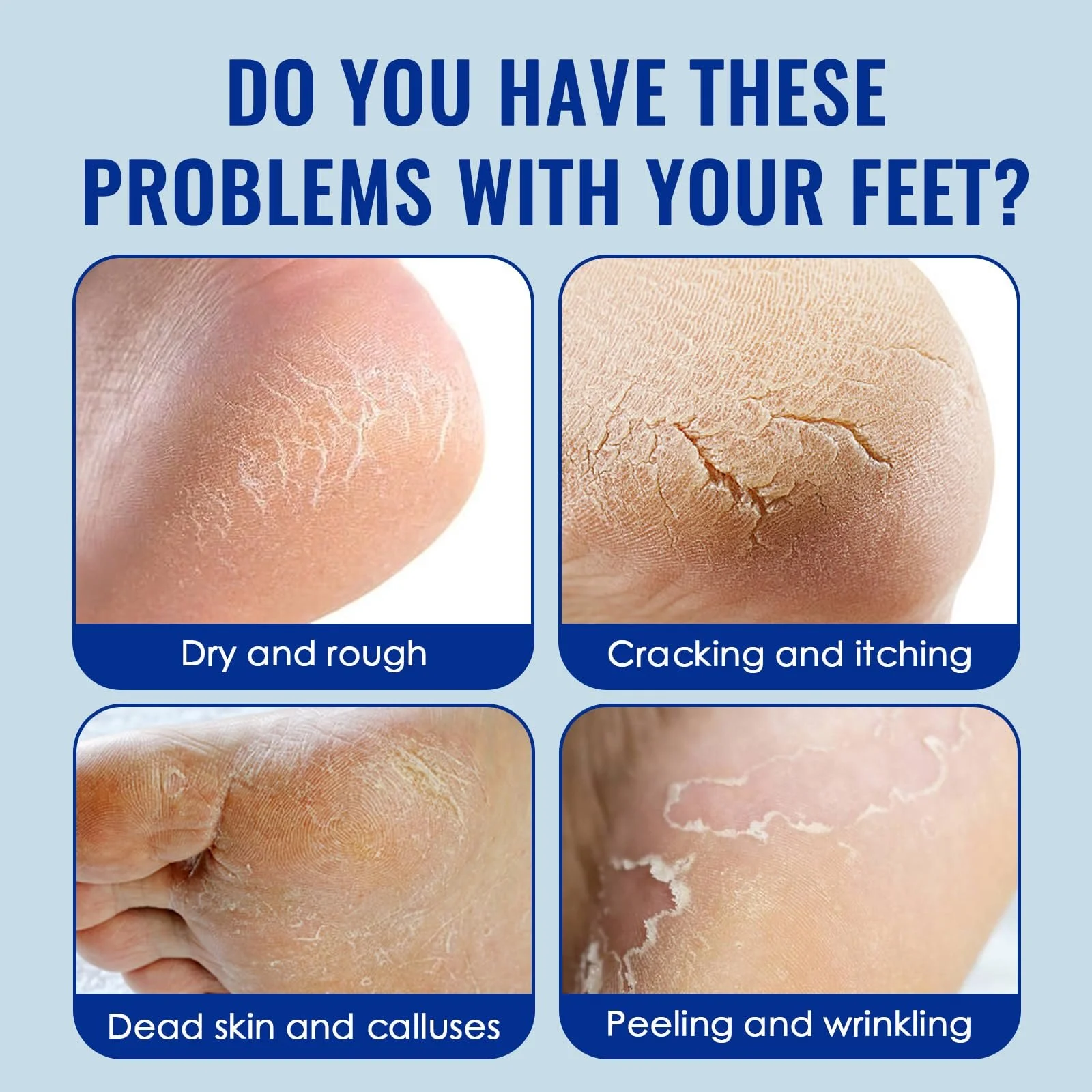 Набор кремов для рук и ног Urea Cream 40% от трещин и мозолей 2 шт по 30 г, фото №4