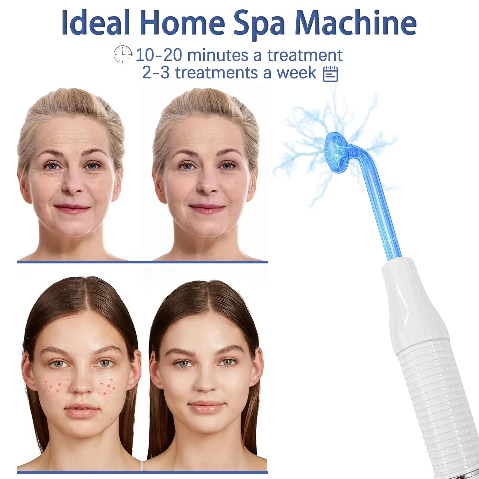 Портативний апарат дарсонваль High Frequency Stick Face з 4 насадками Blue, фото №4